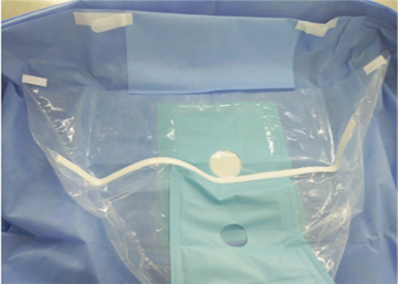 Fluid Collection Sterilization Pouches Class I 20 - 90g Within 10 Days After Payment